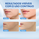 LumiSkin — Tecnologia de Contorno Facial que Cabe na Sua Rotina